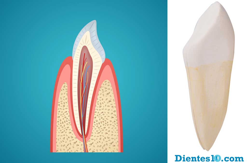 diente-canino-por-palatina