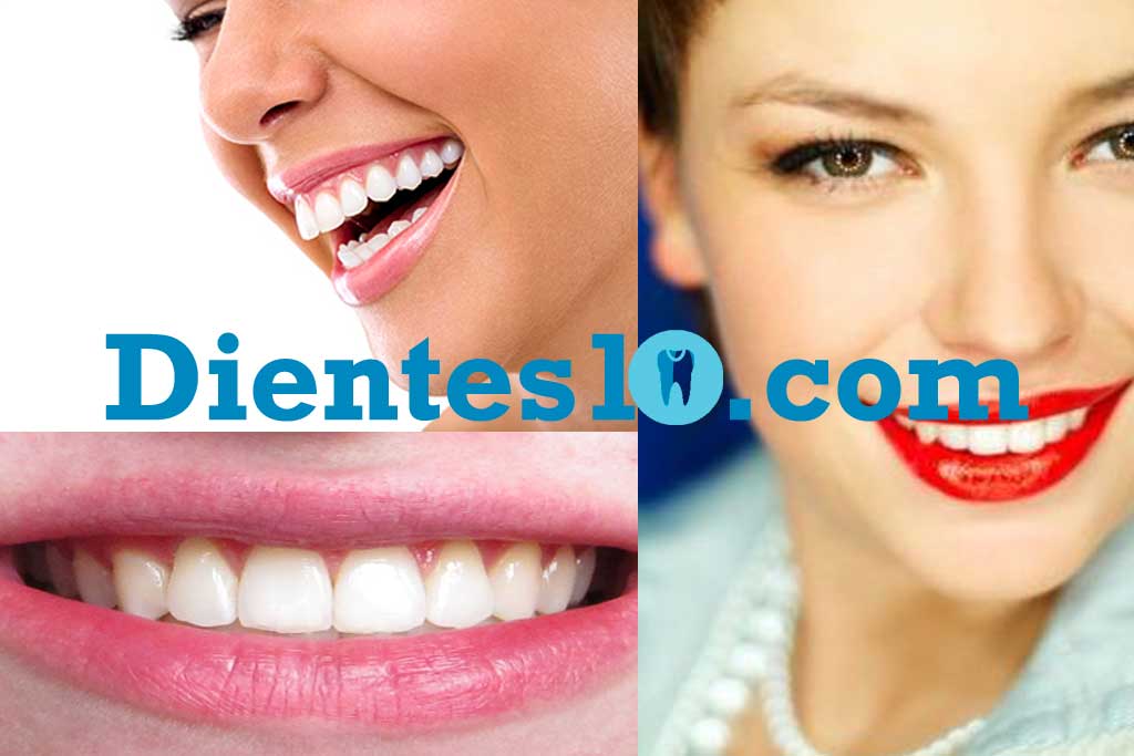 dientes-perfectos