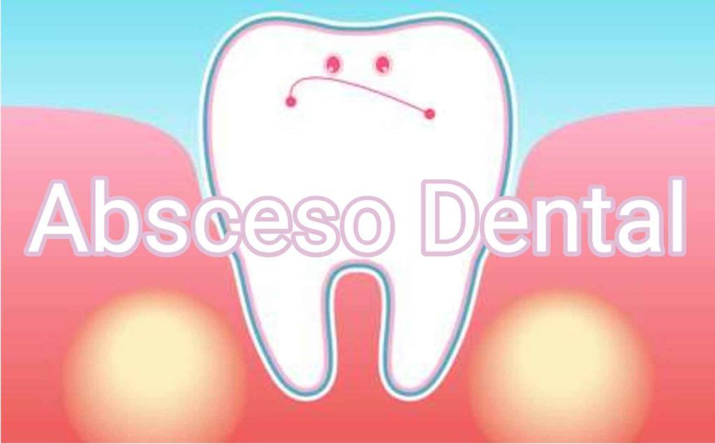 absceso-dental