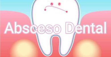 absceso-dental