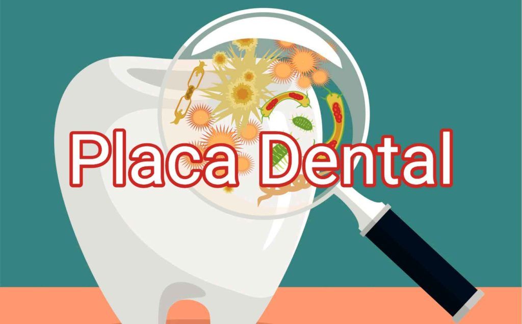 placa-dental