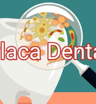 placa-dental