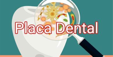 placa-dental