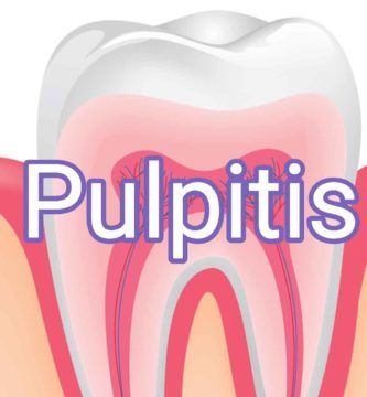 pulpitis