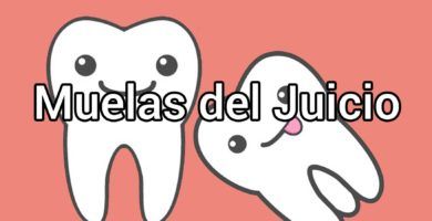 muelas-del-juicio