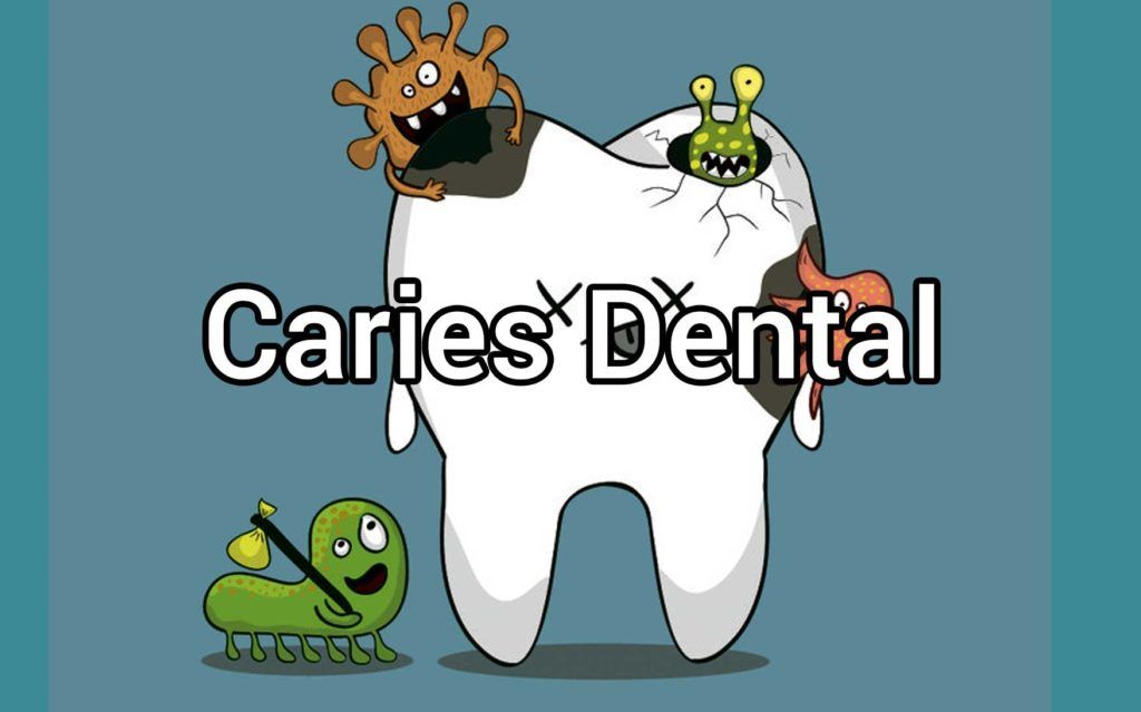 caries-dental