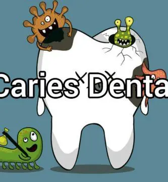 caries-dental
