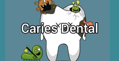 caries-dental