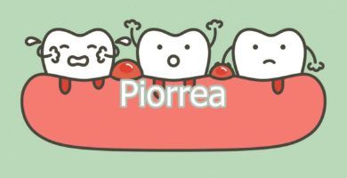 piorrea