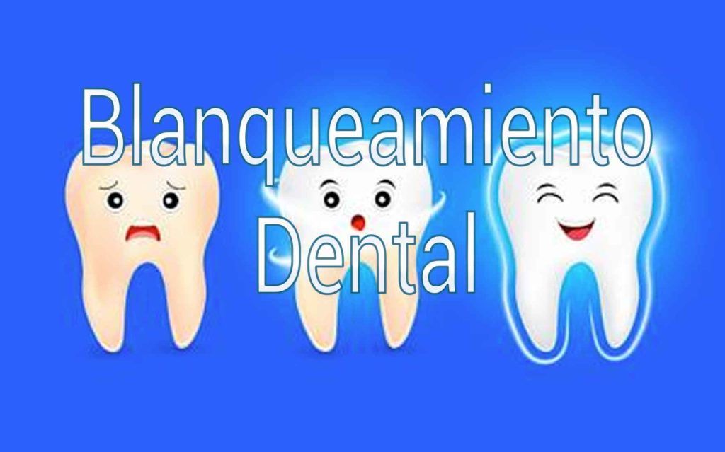 blanqueamiento-dental