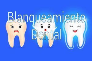 blanqueamiento-dental