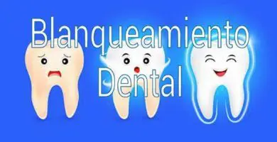 ¿Cual es el mejor tratamiento para blanquear los dientes? 6 blanqueamiento-dental