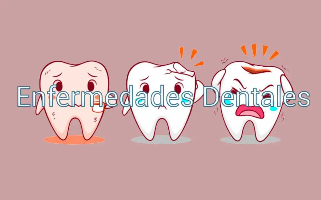 Enfermedades Dentales 1 enfermedades-dentales