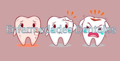 enfermedades-dentales