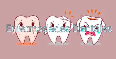 enfermedades-dentales