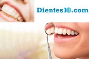 periodontitis