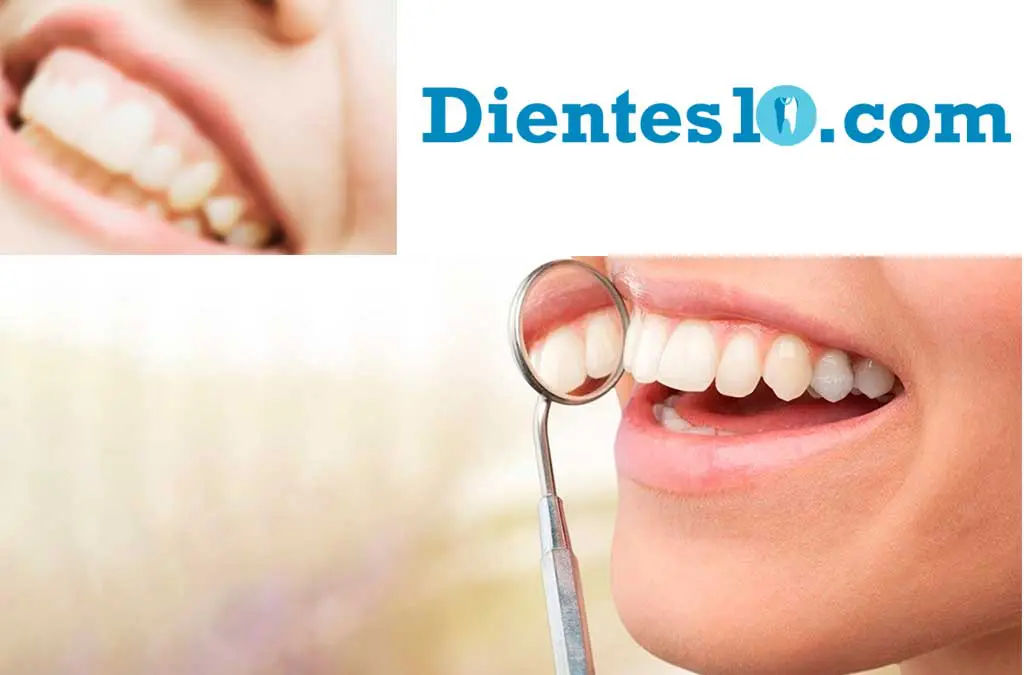 Aprende cómo cuidar tu prótesis dental 1 periodontitis