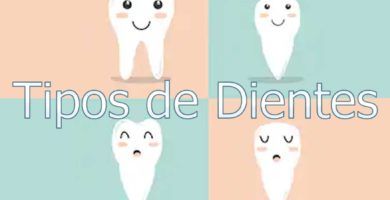 Pegamento para protesis dental El pegamento para dentadura dental, se utiliza en las prótesis removibles mucosoportadas. Este adhesivo ayudará a mantenerla fija en la boca y evitará cualquier evento desafortunado. Existen muchos tipos y marcas en el mercado, por lo que podrás asesorarte con tu médico a fin de que le proporciones las opciones más convenientes para su caso. Actualmente existe un nuevo producto que está sustituyendo el pegamento habitual, que se llama resina dental blanda. Esta técnica, es más costosa debido a que la debe hacer un profesional, sin embargo los efectos son tan buenos que valdría la pena. Esta técnica es llamada “rebase dental blando”  y consiste en ajustar la prótesis dental con una resina dental dura o blanda. [amazon bestseller="pegamento dentadura postiza"] Cómo aplicar el pegamento para dientes provisionales [su_list icon="icon: long-arrow-right" icon_color="#4e85bb"] Lo primero que debemos hacer, es asegurarnos de que la prótesis dental está limpia y completamente seca. Iniciamos colocando el pegamento en una serie de puntos o franjas, se debe colocar siempre una pequeña cantidad y evitar hacerlo cerca del borde de la prótesis. Presionar firmemente la prótesis al momento de colocarla presionando. Una solo aplicación al día debería ser suficiente, en el caso de necesitarlo más veces, es probable que deba ir al dentista para revisar las posibles causas y conseguir una mejor adaptación. Al quitarse la prótesis debe utilizar un producto especial para este tipo de dentaduras. Debe limpiar de cualquier residuo de pegamento la dentadura postiza, para lo cual puede usar agua tibia y un cepillo de cerdas suaves. [/su_list]