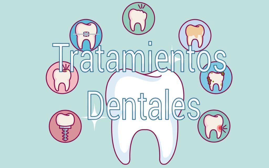 tratamientos-dentales