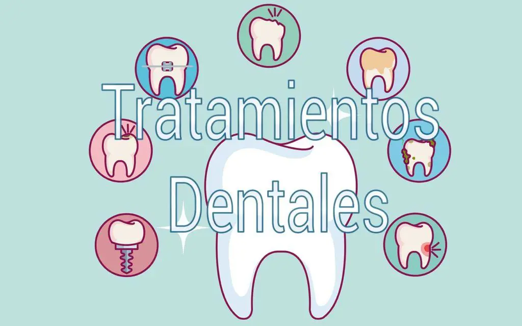 Tratamientos Dentales 1 tratamientos-dentales