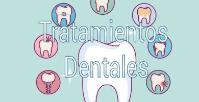 tratamientos-dentales