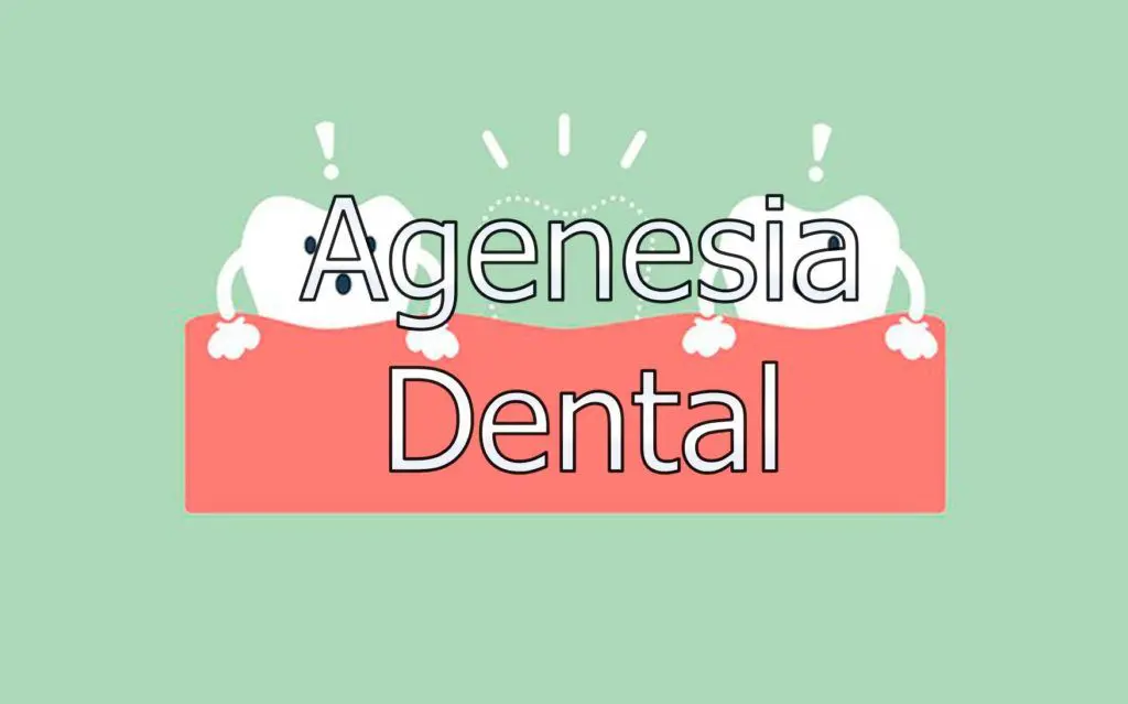 Agenesia Dental 1 agenesia-dental