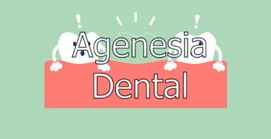 agenesia-dental