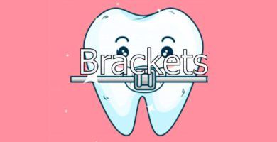 brackets