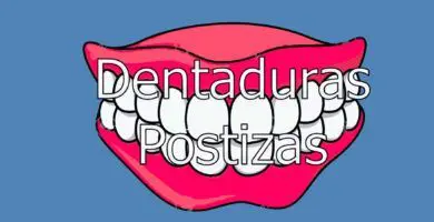 dentadura-postiza