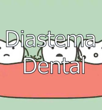 diastema-dental