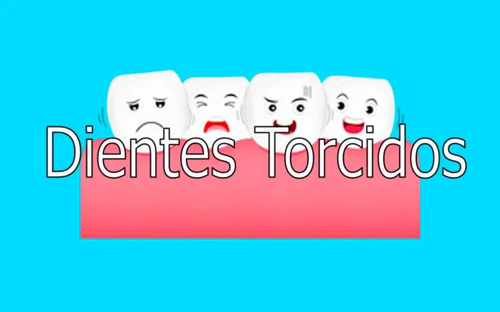 Dientes torcidos 1 dientes-torcidos