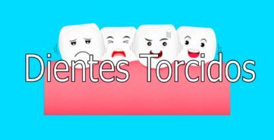 dientes-torcidos