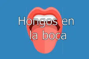 candidiasis-en-la-boca