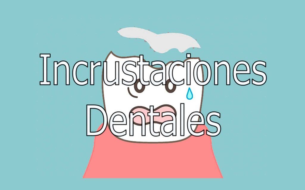 incrustaciones-dentales