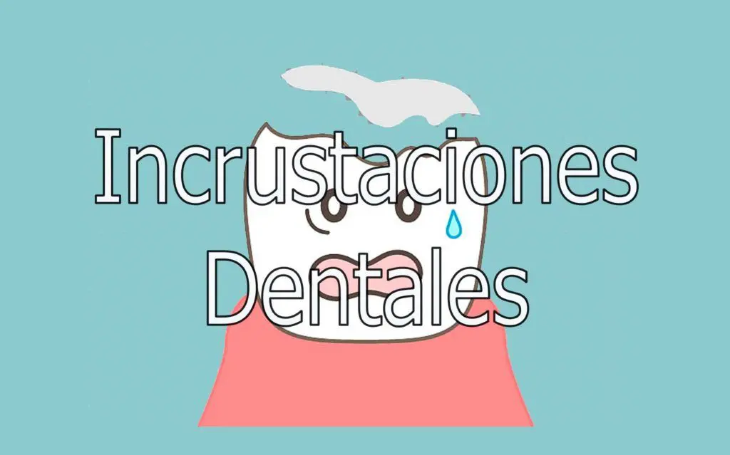 Incrustaciones dentales 1 incrustaciones-dentales