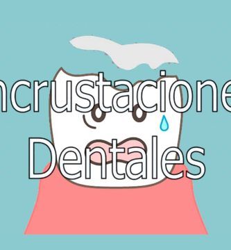 incrustaciones-dentales