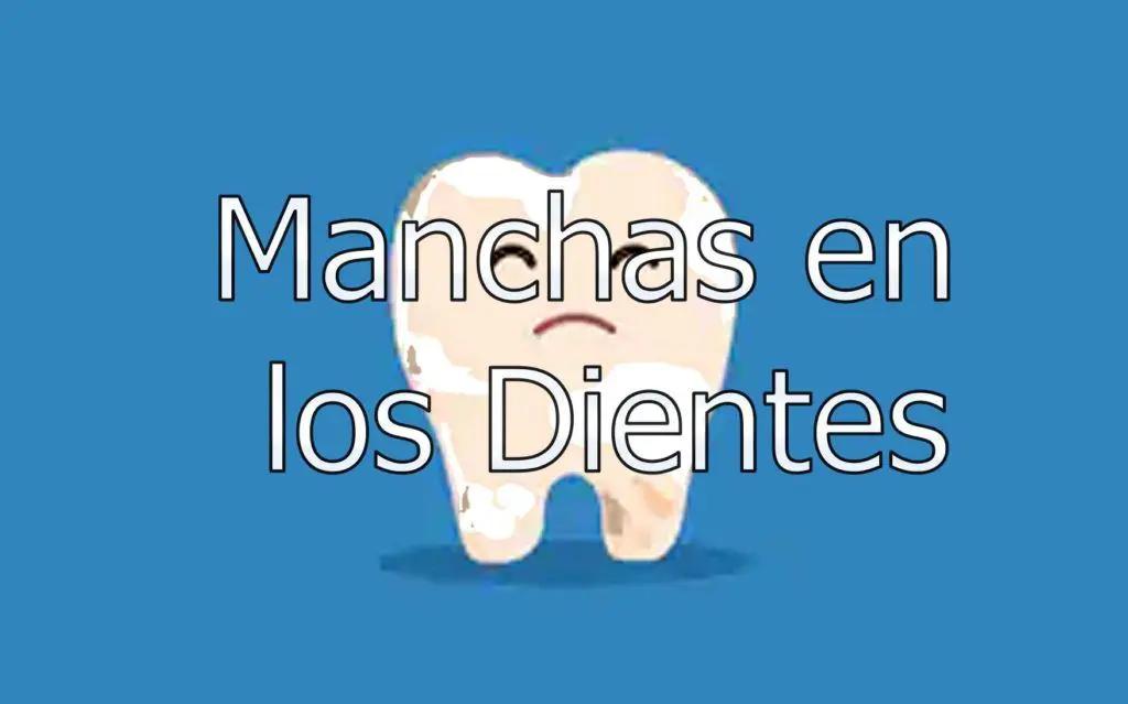 Manchas en los Dientes 1 manchas-en-los-dientes
