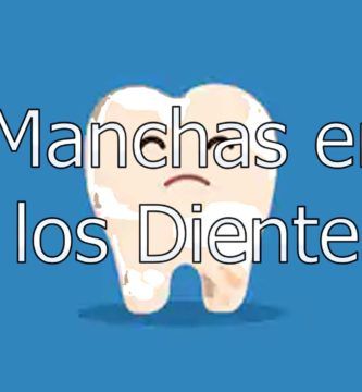 manchas-en-los-dientes