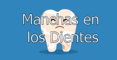 manchas-en-los-dientes