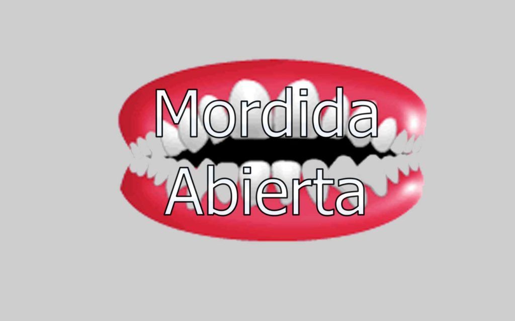 mordida-abierta