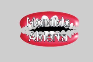 mordida-abierta