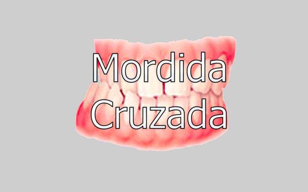 mordida-cruzada