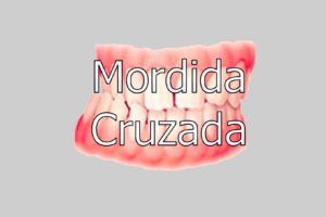 mordida-cruzada