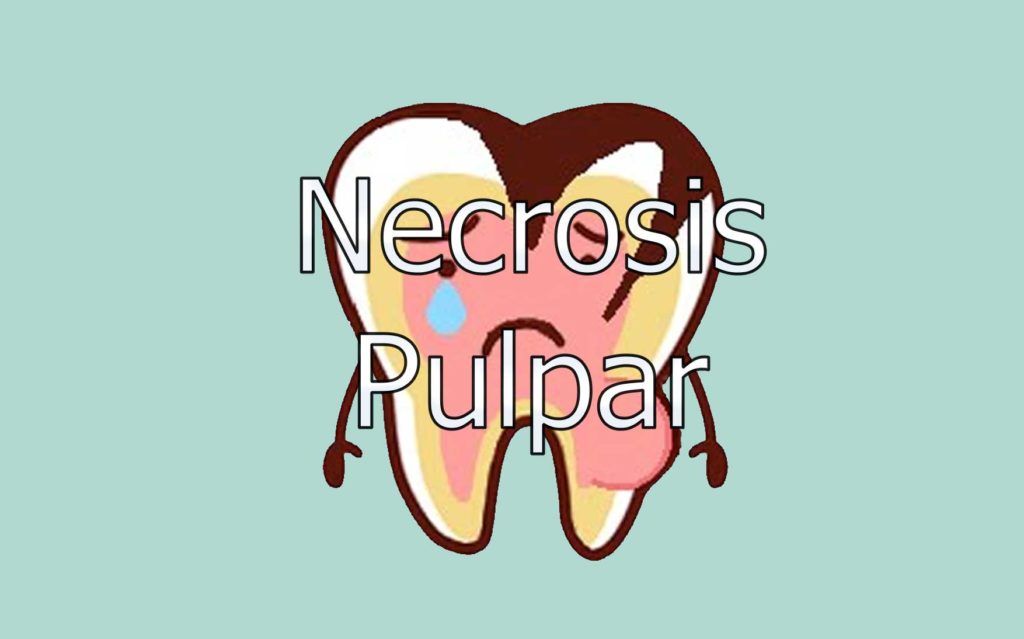necrosis-pulpar