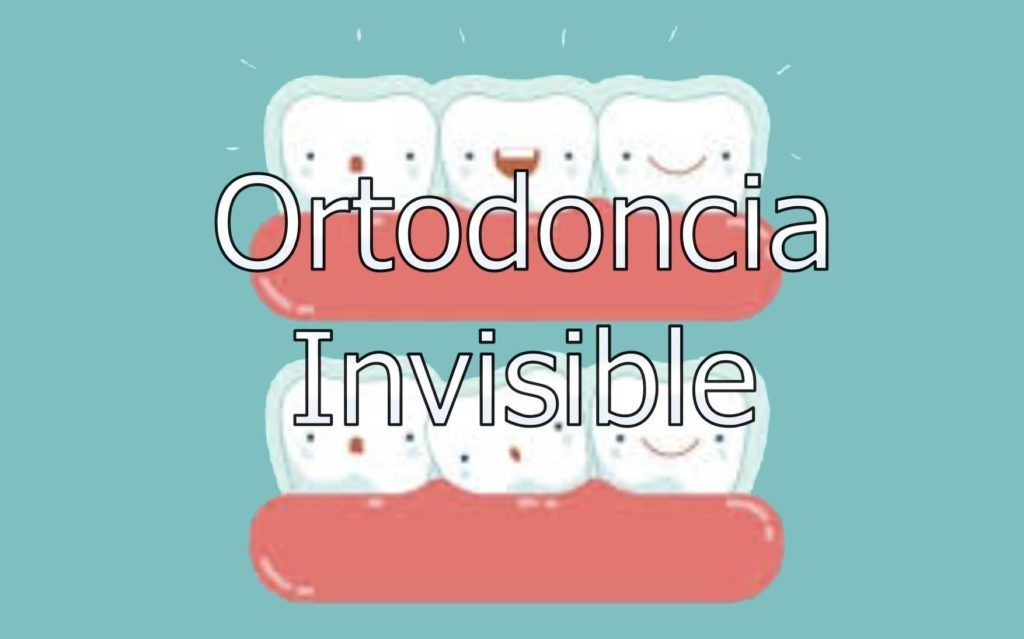 ortodoncia-invisible