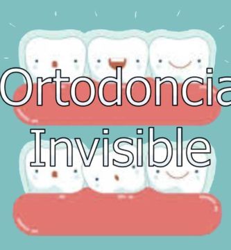 ortodoncia-invisible