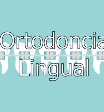 ortodoncia-lingual