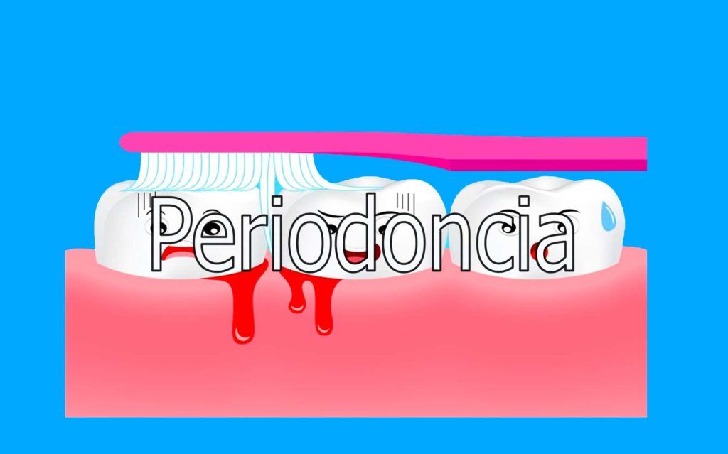 periodoncia