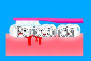 periodoncia