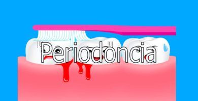 periodoncia